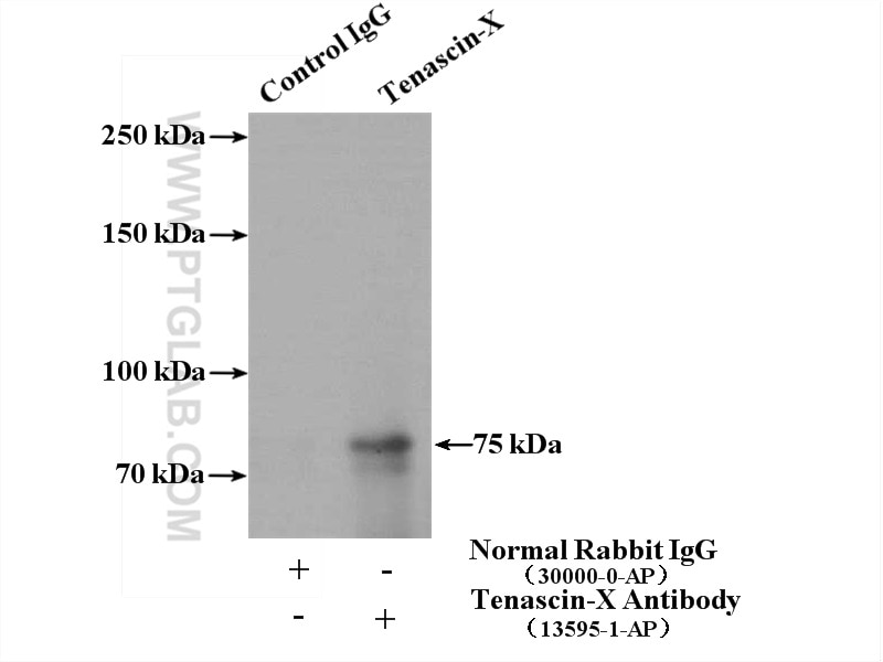 Immunoprecipitation (IP) experiment of mouse liver tissue using Tenascin-X Polyclonal antibody (13595-1-AP)