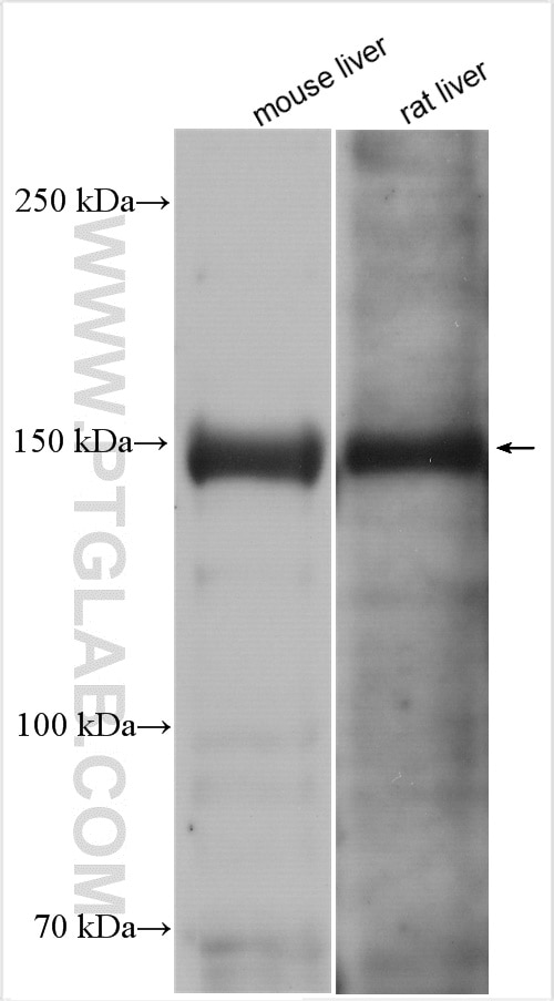 Western Blot (WB) analysis of various lysates using Tenascin-X Polyclonal antibody (13595-1-AP)