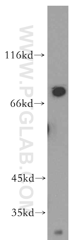 Western Blot (WB) analysis of mouse liver tissue using Tenascin-X Polyclonal antibody (13595-1-AP)