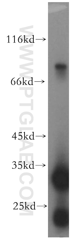 Western Blot (WB) analysis of HT-1080 cells using Tenascin-X Polyclonal antibody (13595-1-AP)