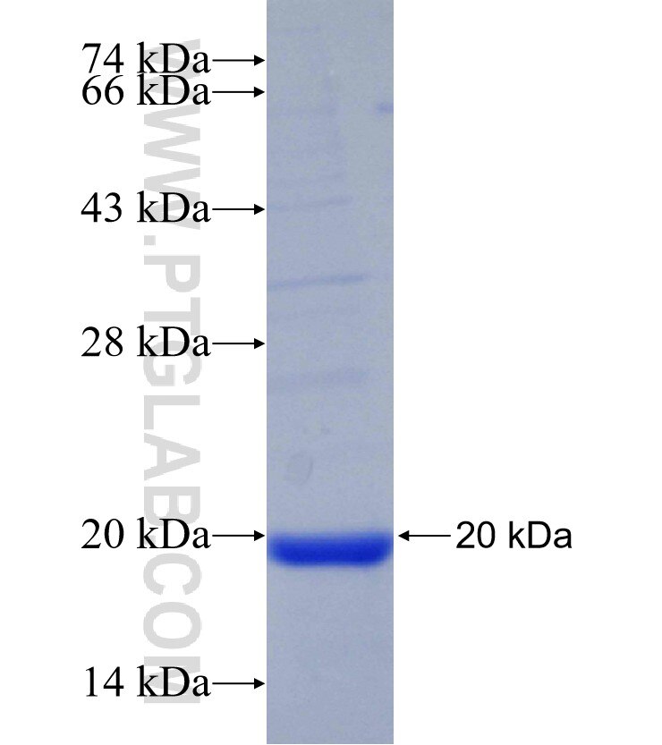 TNXB fusion protein Ag30582 SDS-PAGE TNXB fusion protein Ag30582 SDS-PAGE