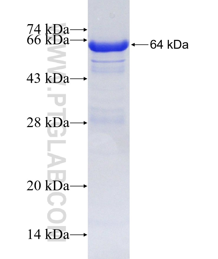 TNXB fusion protein Ag4501 SDS-PAGE