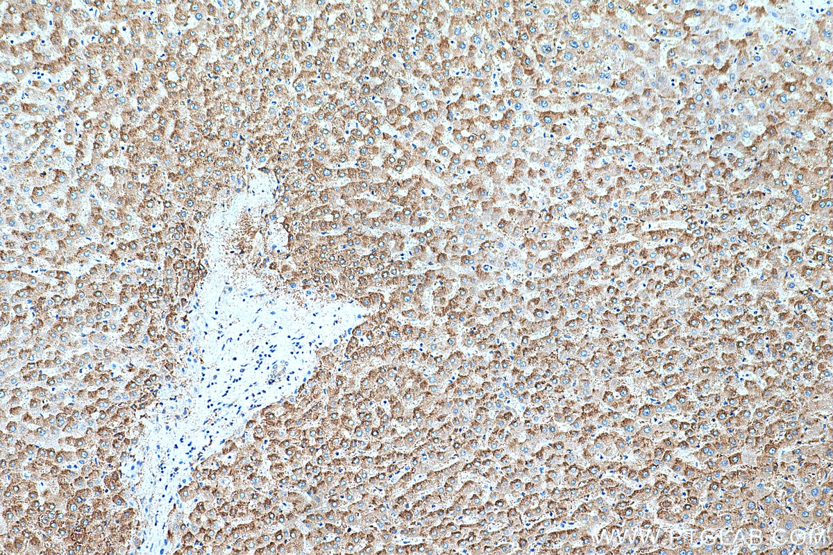 Immunohistochemistry (IHC) staining of human liver tissue using TOAG1 Polyclonal antibody (21564-1-AP)