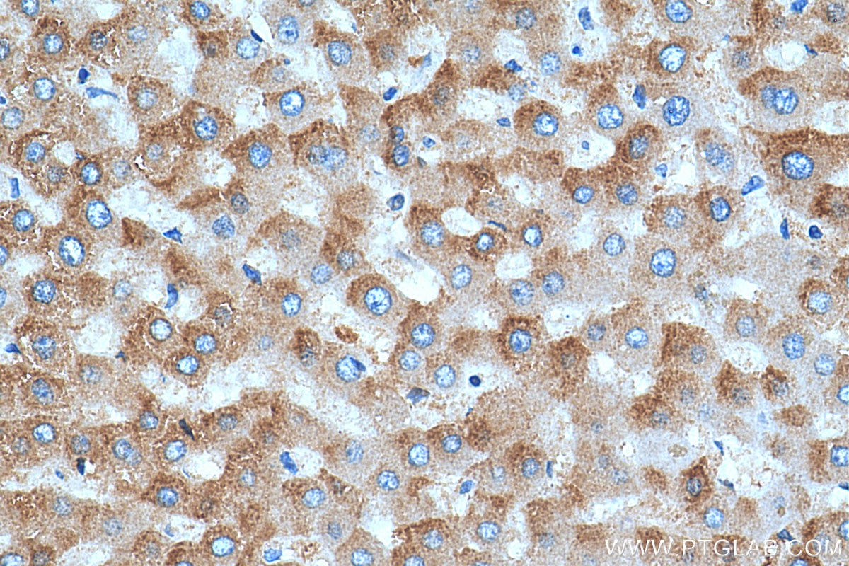 Immunohistochemistry (IHC) staining of human liver tissue using TOAG1 Polyclonal antibody (21564-1-AP)