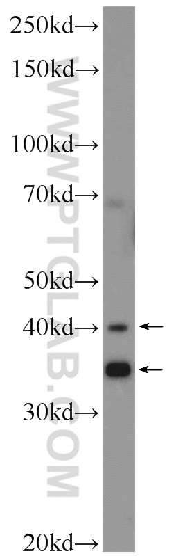 Western Blot (WB) analysis of HEK-293 cells using TOAG1 Polyclonal antibody (21564-1-AP)