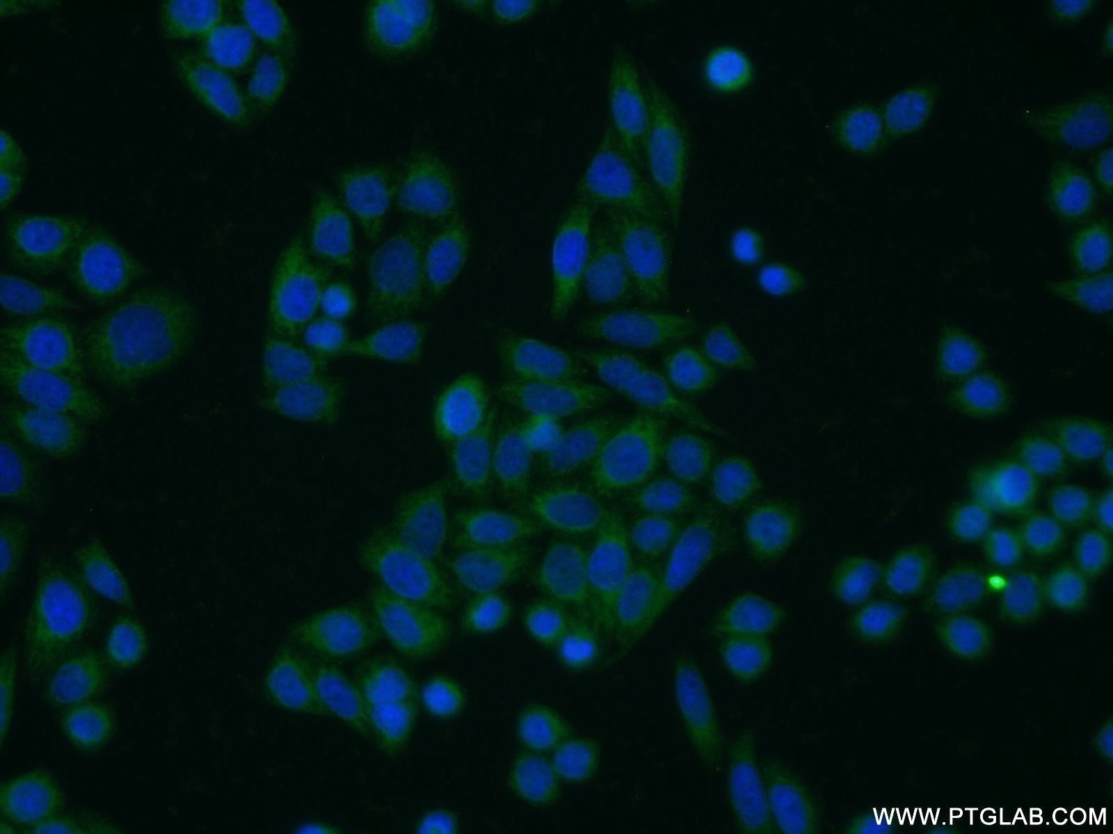 Immunofluorescence (IF) / fluorescent staining of HeLa cells using TOB1 Polyclonal antibody (14915-1-AP)