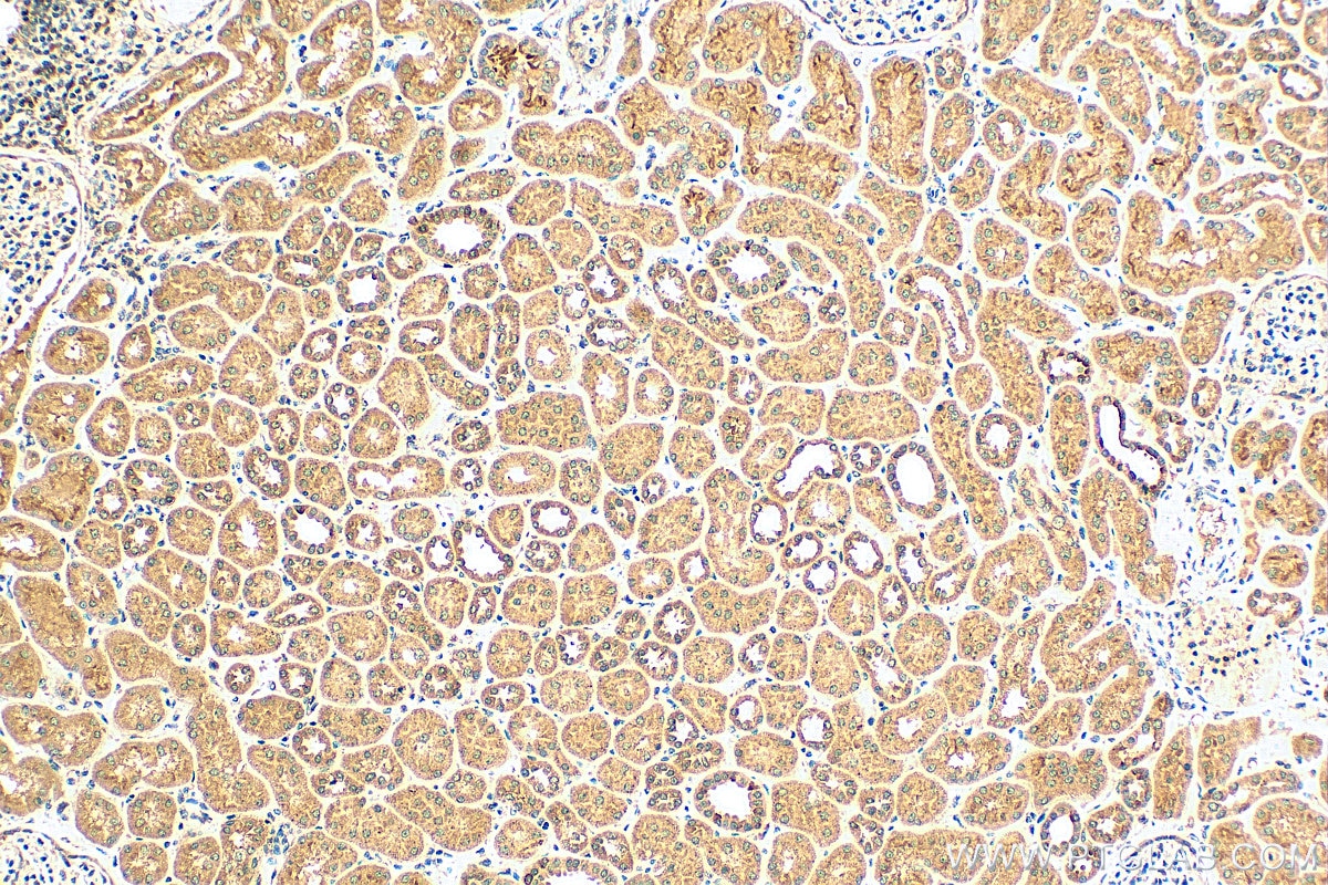 IHC staining of human kidney using 13607-1-AP