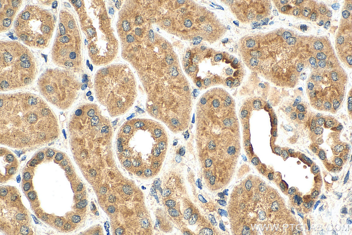 Immunohistochemistry (IHC) staining of human kidney tissue using TOB2 Polyclonal antibody (13607-1-AP)