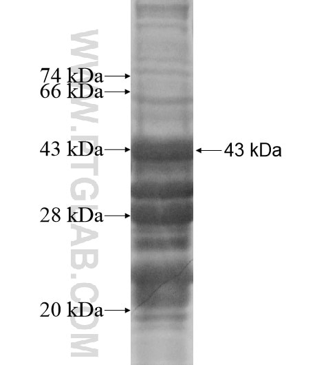 TOB2 fusion protein Ag14476 SDS-PAGE