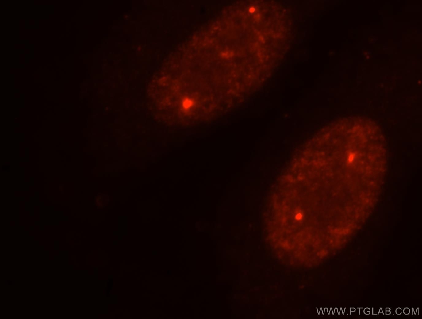 Immunofluorescence (IF) / fluorescent staining of HepG2 cells using TOE1 Polyclonal antibody (16203-1-AP)