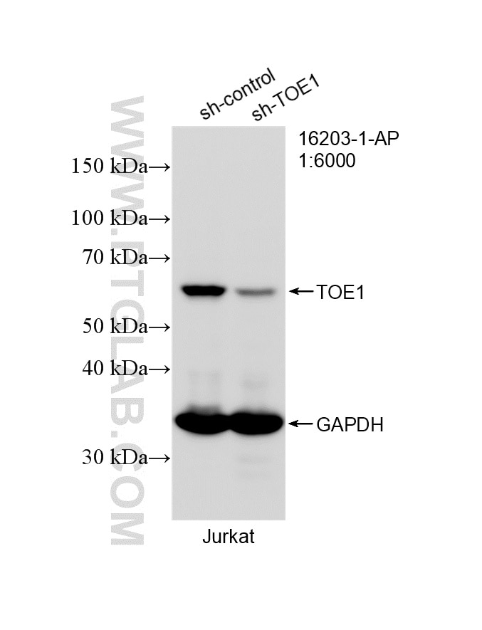WB analysis of Jurkat using 16203-1-AP Western Blot (WB) analysis of Jurkat cells using TOE1 Polyclonal antibody (16203-1-AP)