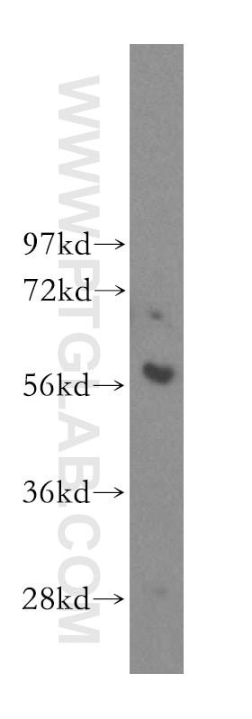 Western Blot (WB) analysis of mouse thymus tissue using TOE1 Polyclonal antibody (16203-1-AP)