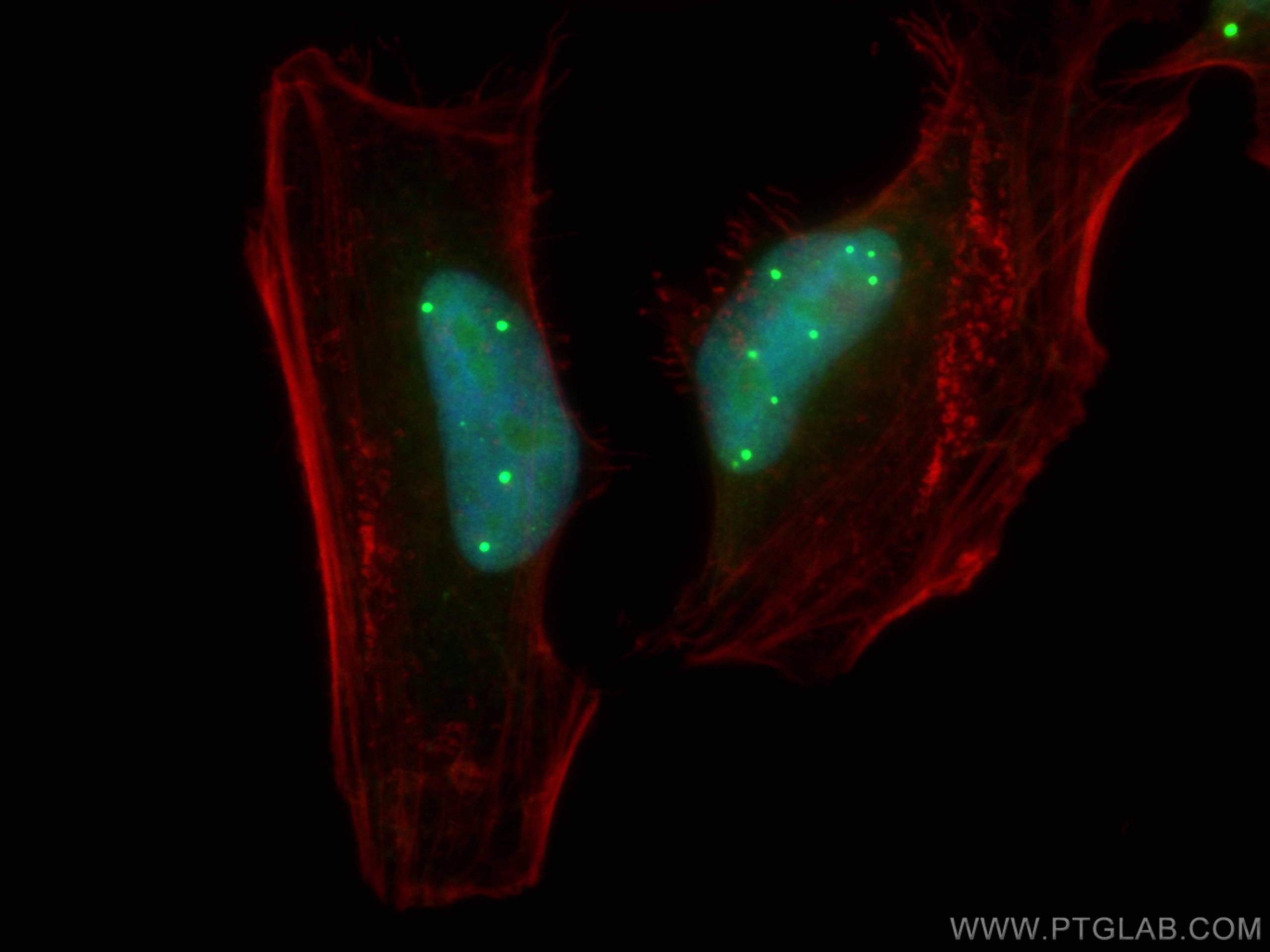 Immunofluorescence (IF) / fluorescent staining of HeLa cells using TOE1 Polyclonal antibody (30221-1-AP)