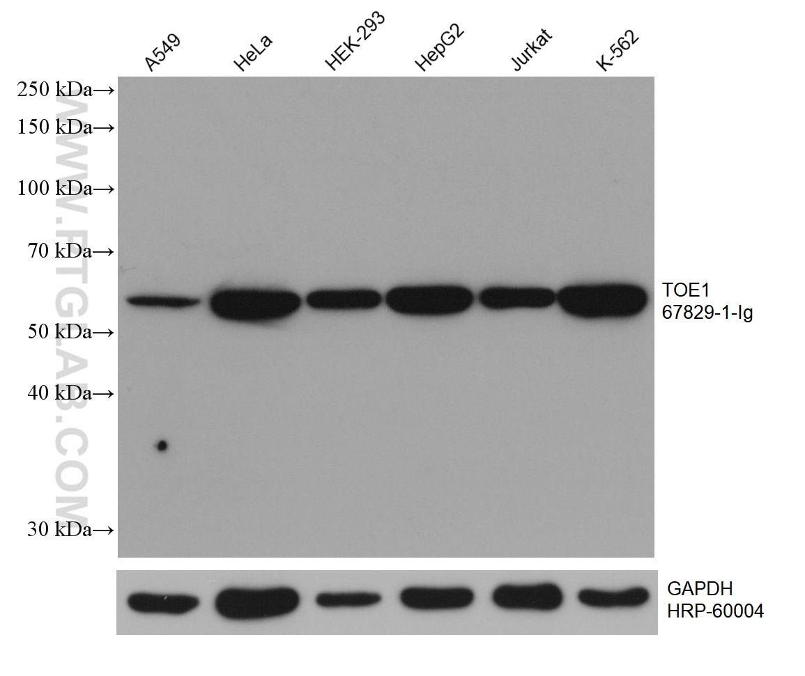 WB analysis using 67829-1-Ig