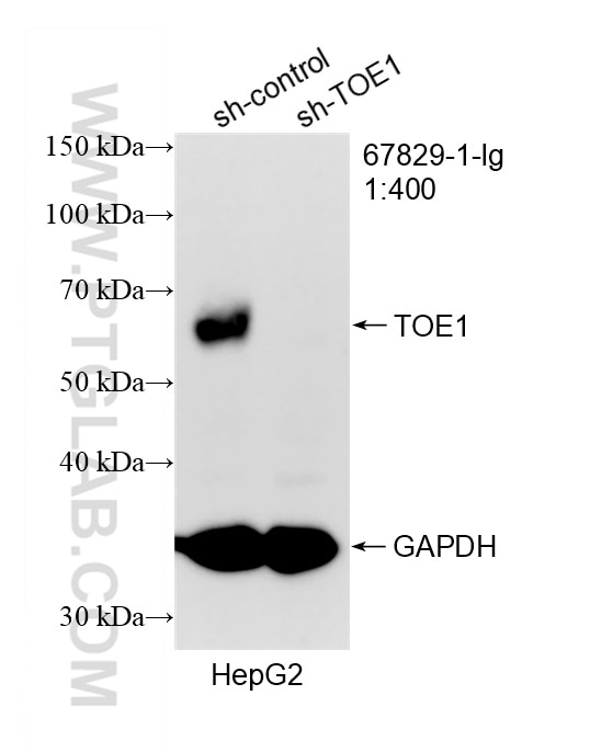 WB analysis of HepG2 using 67829-1-Ig Western Blot (WB) analysis of HepG2 cells using TOE1 Monoclonal antibody (67829-1-Ig)