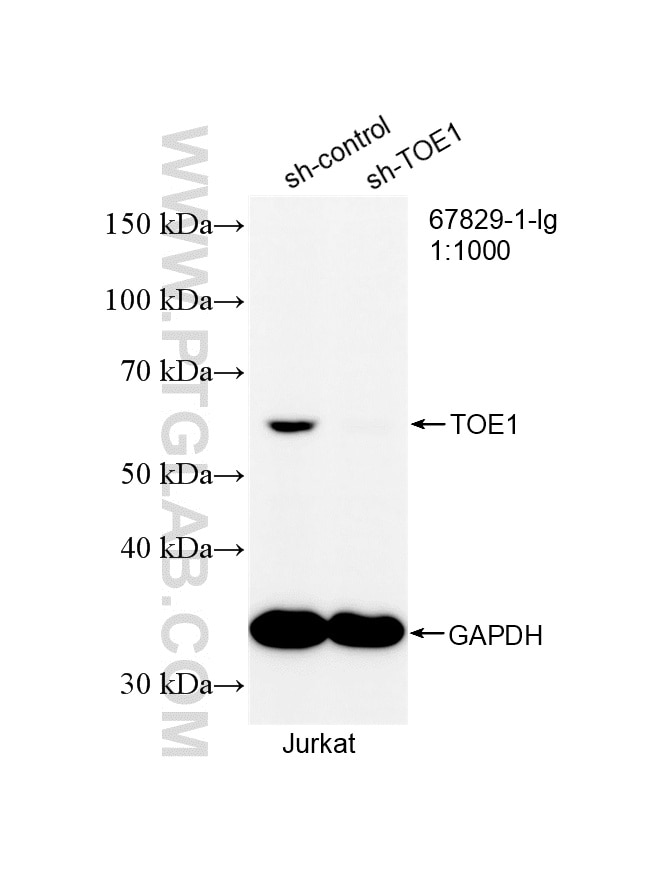 WB analysis of Jurkat using 67829-1-Ig Western Blot (WB) analysis of Jurkat cells using TOE1 Monoclonal antibody (67829-1-Ig)