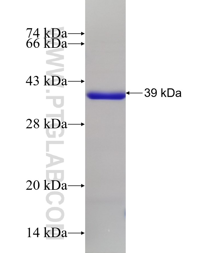 TOE1 fusion protein Ag28982 SDS-PAGE