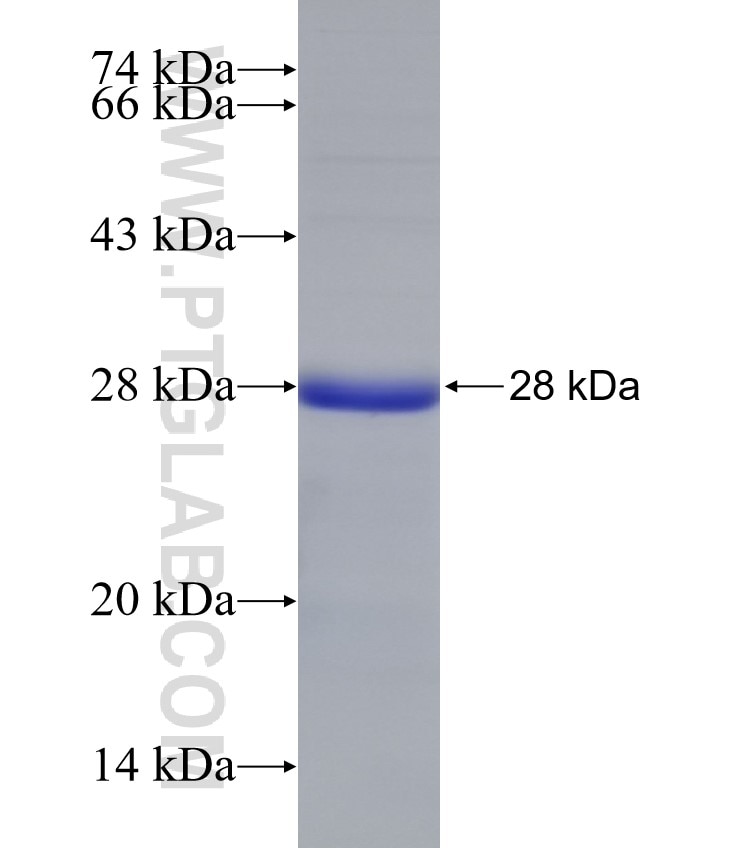 TOE1 fusion protein Ag31437 SDS-PAGE TOE1 fusion protein Ag31437 SDS-PAGE