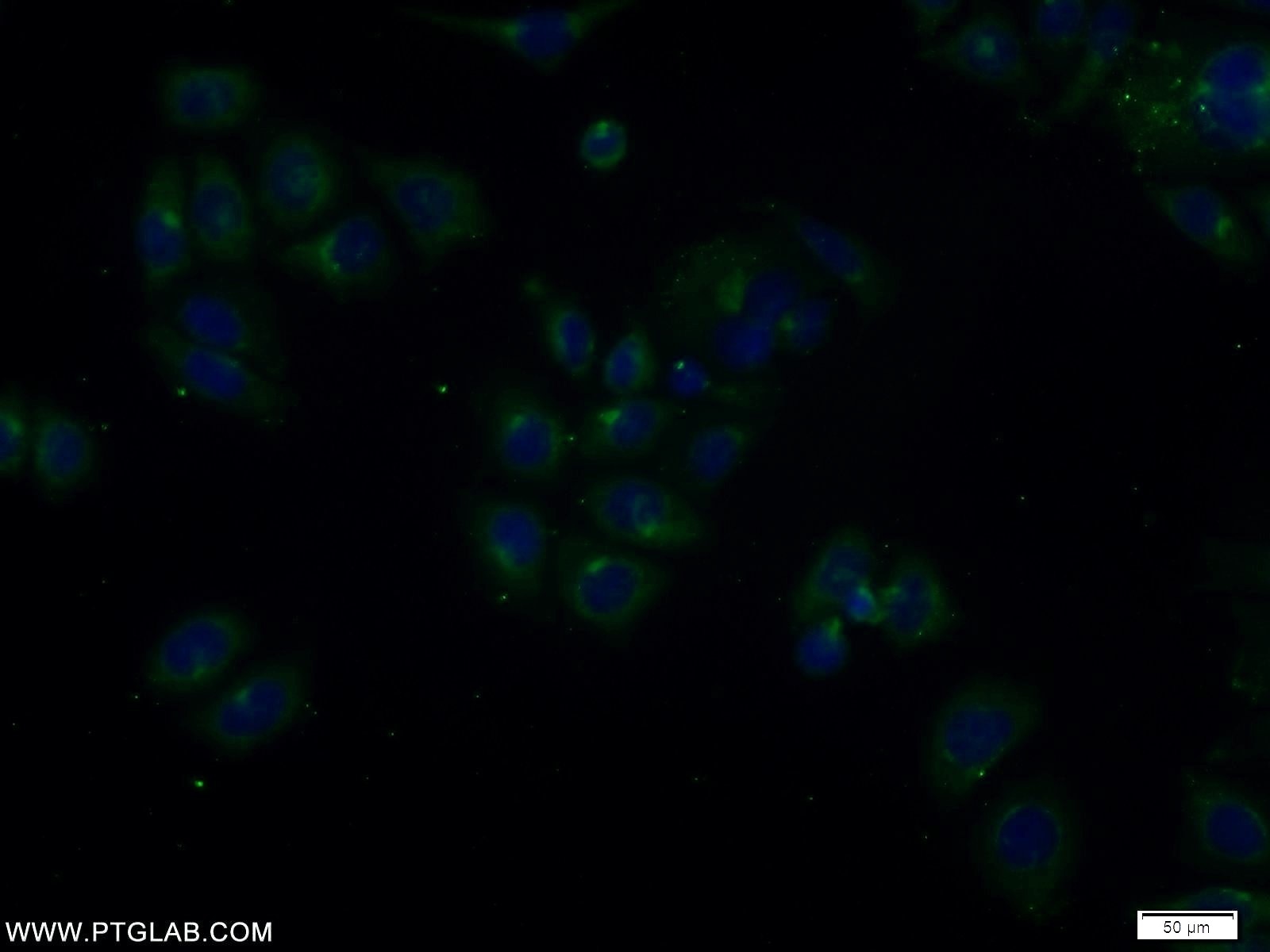 Immunofluorescence (IF) / fluorescent staining of PC-3 cells using TOLLIP Polyclonal antibody (11315-1-AP)
