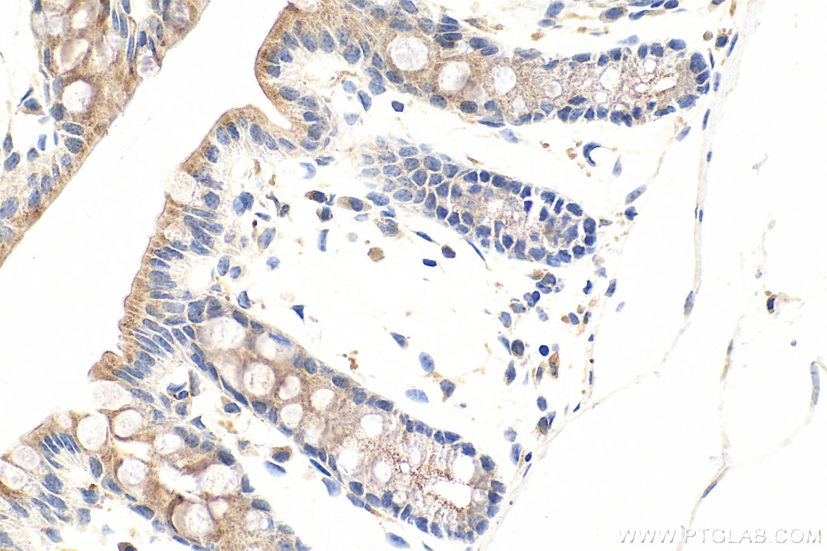 Immunohistochemistry (IHC) staining of mouse colon tissue using TOLLIP Polyclonal antibody (11315-1-AP)