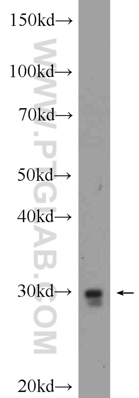 Western Blot (WB) analysis of rat brain tissue using TOLLIP Polyclonal antibody (11315-1-AP)