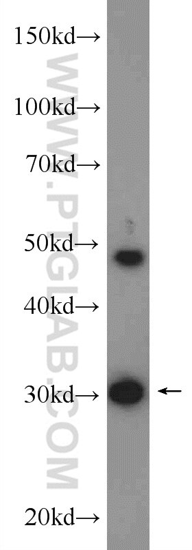 Western Blot (WB) analysis of mouse brain tissue using TOLLIP Polyclonal antibody (11315-1-AP)