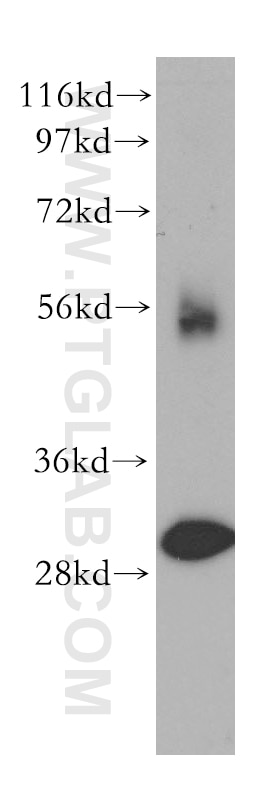 Western Blot (WB) analysis of HEK-293 cells using TOLLIP Polyclonal antibody (11315-1-AP)