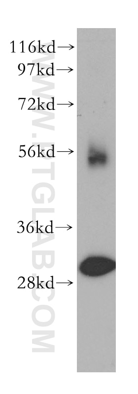 WB analysis of HEK-293 using 11315-1-AP