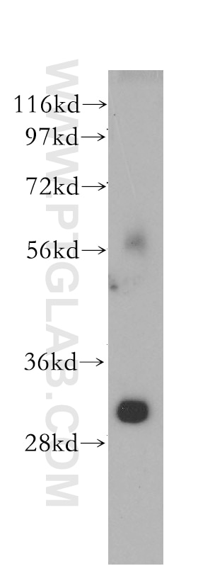 Western Blot (WB) analysis of human liver tissue using TOLLIP Polyclonal antibody (11315-1-AP)