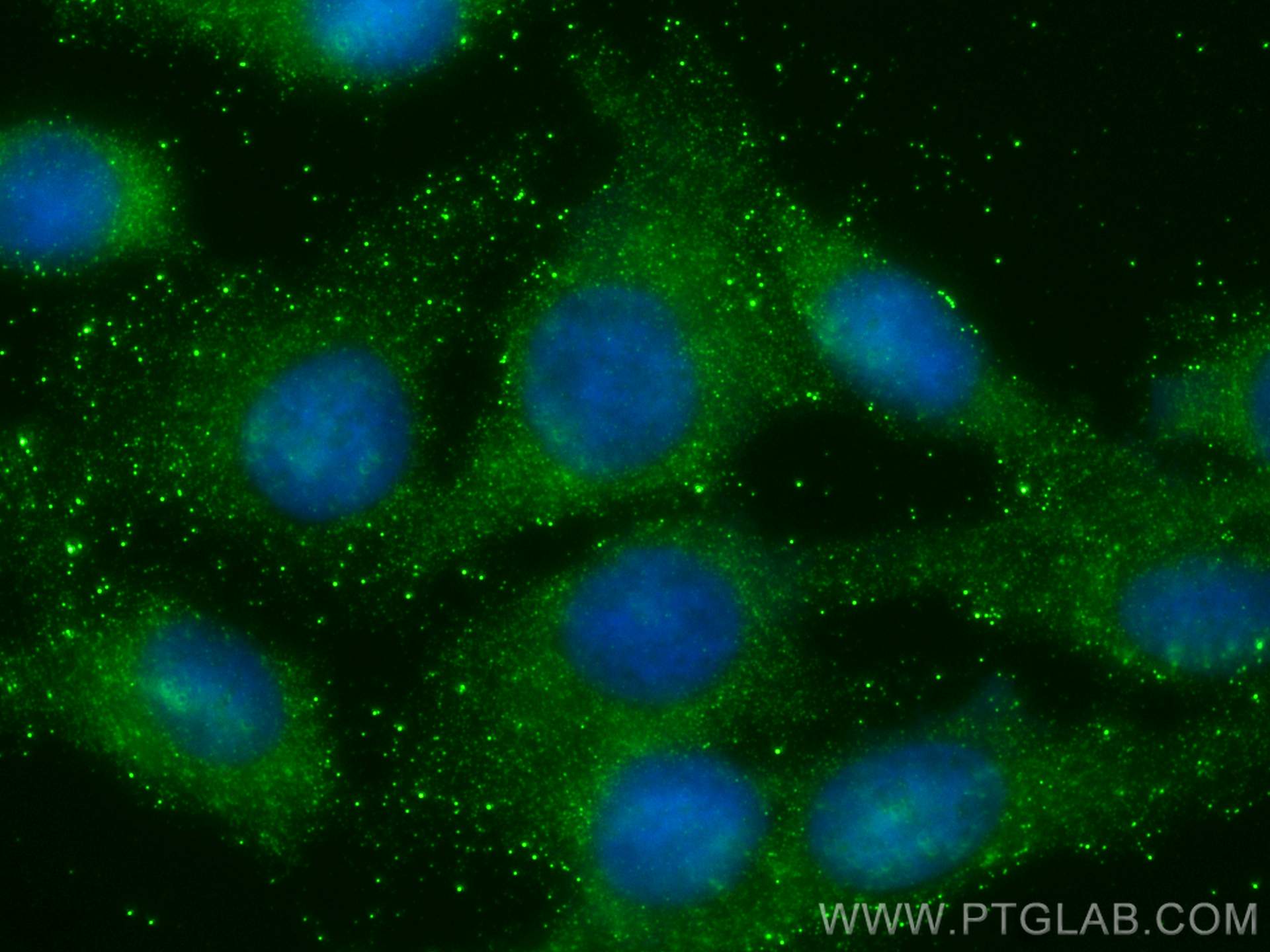 Immunofluorescence (IF) / fluorescent staining of U2OS cells using TOLLIP Monoclonal antibody (68170-1-Ig)