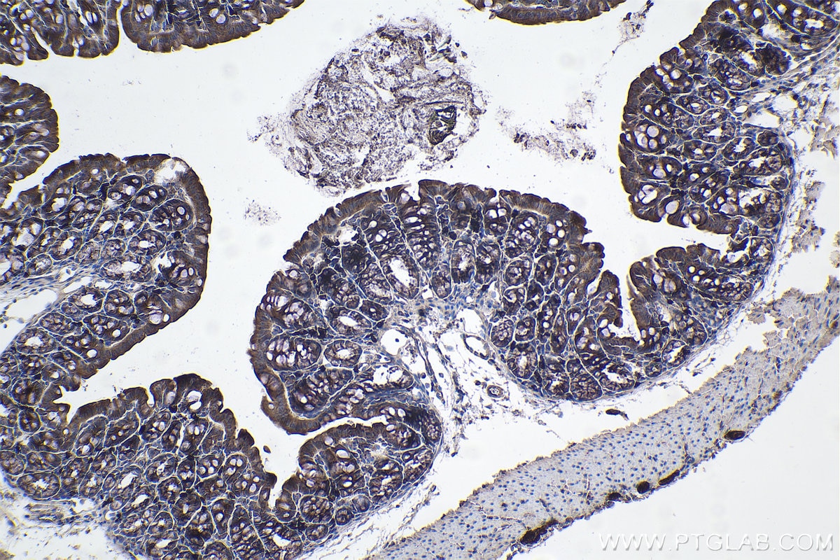 Immunohistochemistry (IHC) staining of mouse colon tissue using TOLLIP Monoclonal antibody (68170-1-Ig)