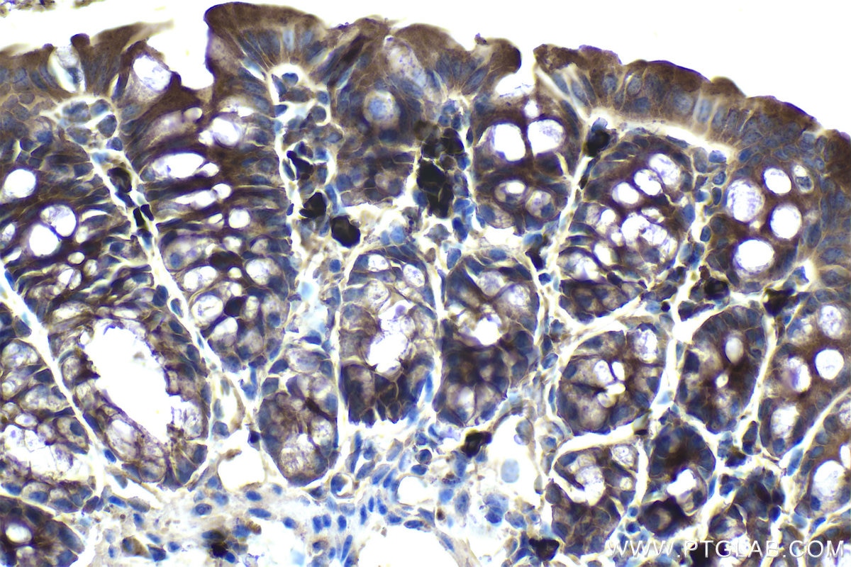 Immunohistochemistry (IHC) staining of mouse colon tissue using TOLLIP Monoclonal antibody (68170-1-Ig)
