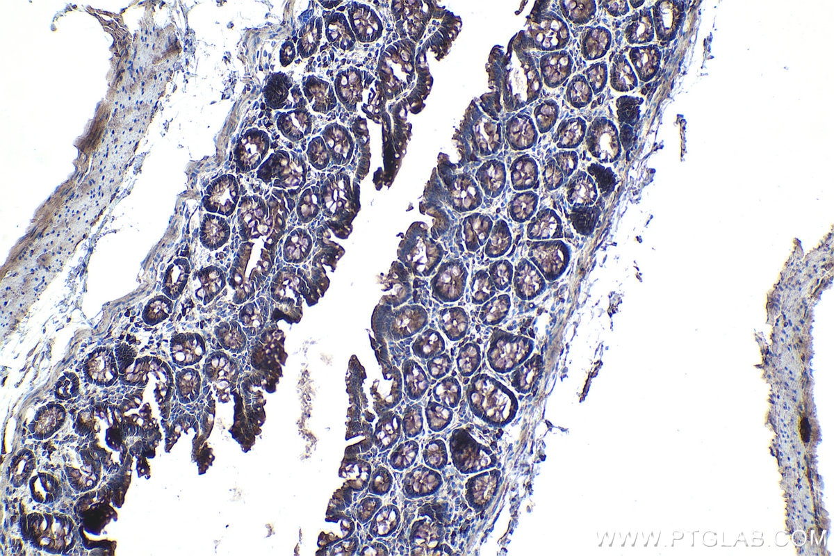 Immunohistochemistry (IHC) staining of rat colon tissue using TOLLIP Monoclonal antibody (68170-1-Ig)