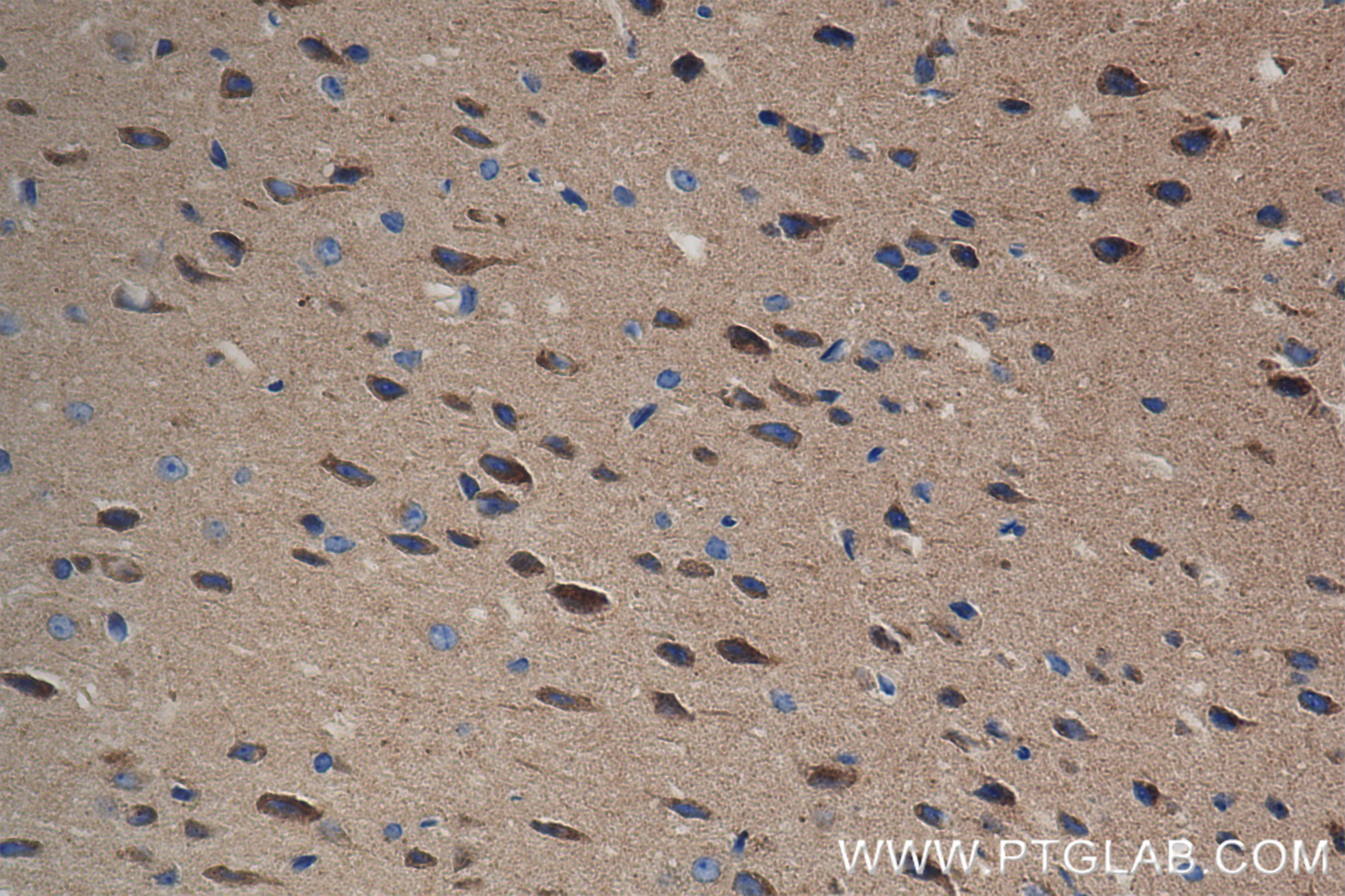 Immunohistochemistry (IHC) staining of mouse brain tissue using TOLLIP Recombinant antibody (84711-5-RR)