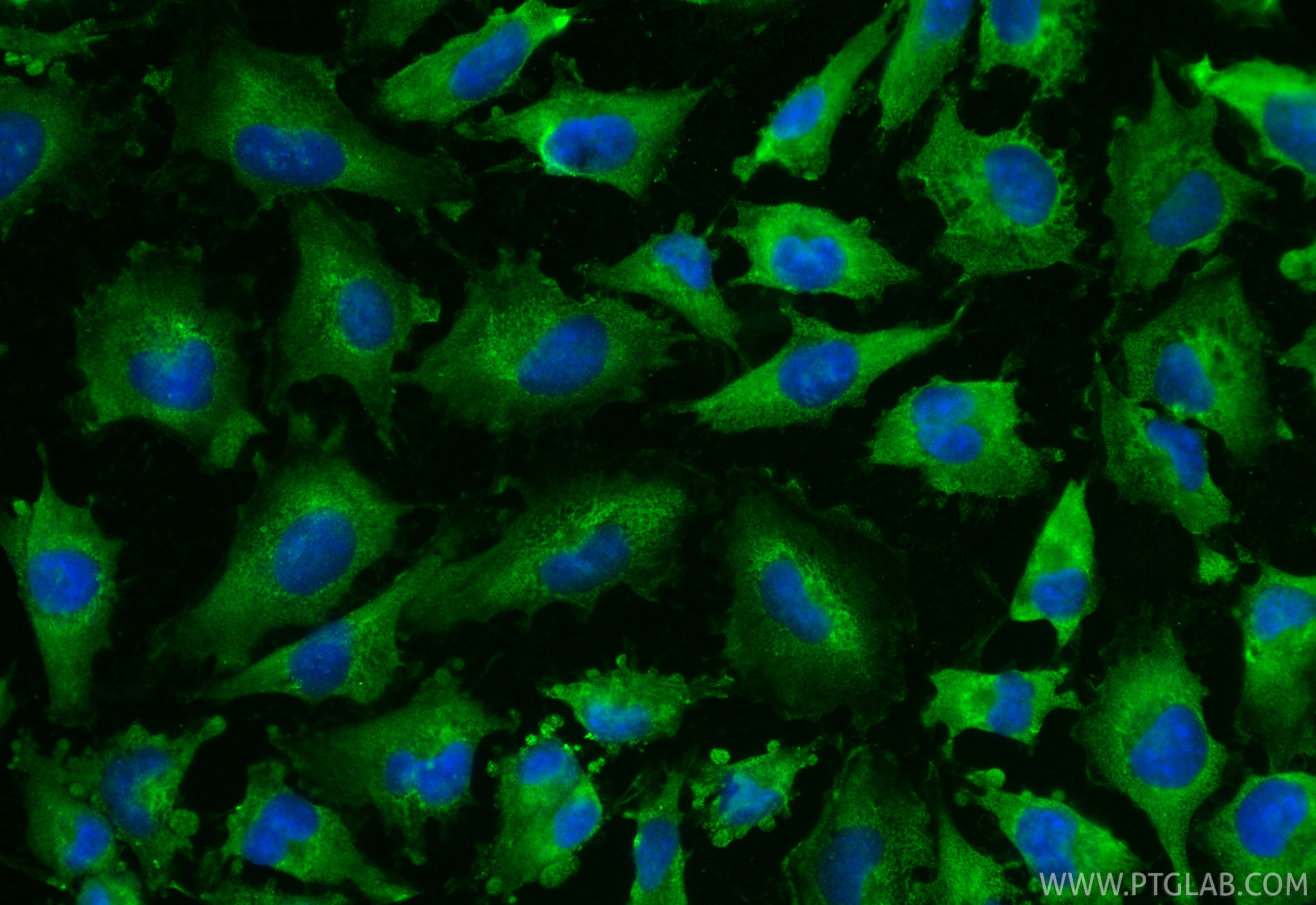 Immunofluorescence (IF) / fluorescent staining of U-251 cells using CoraLite® Plus 488-conjugated TOLLIP Monoclonal an (CL488-68170)