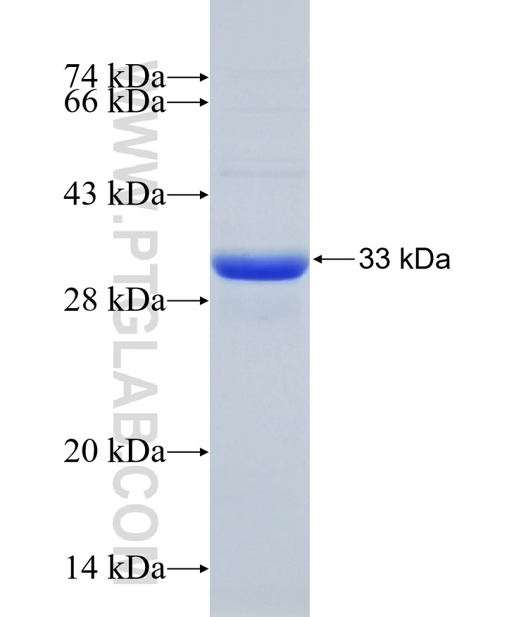 TOLLIP fusion protein Ag32731 SDS-PAGE