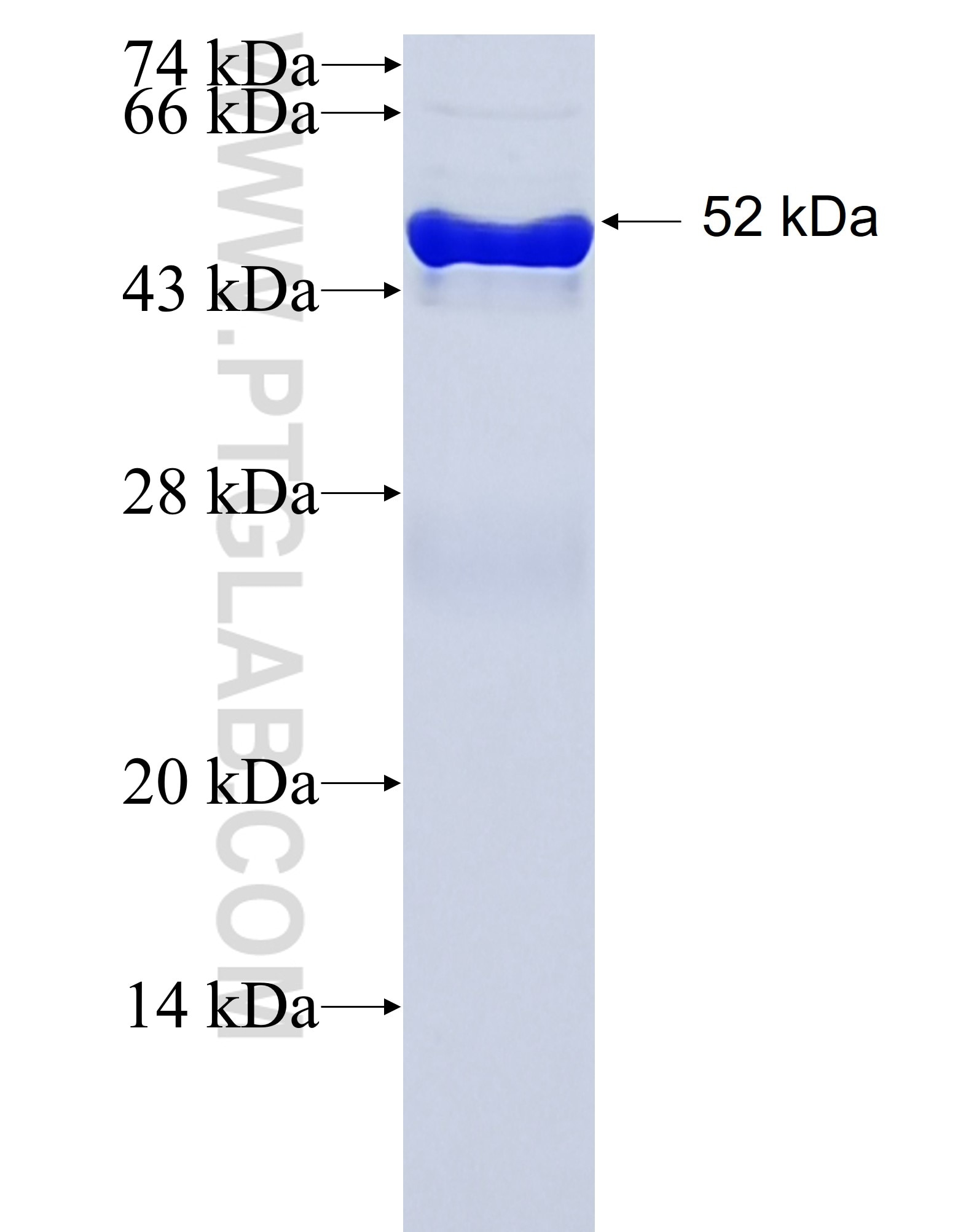 TOLLIP fusion protein Ag1864 SDS-PAGE