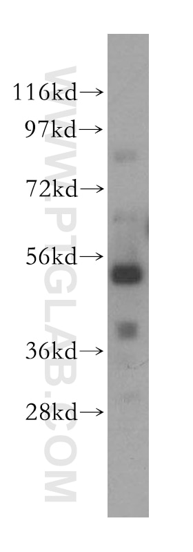 Western Blot (WB) analysis of HeLa cells using TOM1 Polyclonal antibody (17506-1-AP)