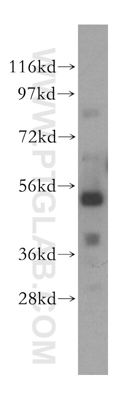 WB analysis of HeLa using 17506-1-AP