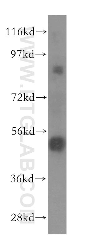 Western Blot (WB) analysis of human liver tissue using TOM1 Polyclonal antibody (17506-1-AP)
