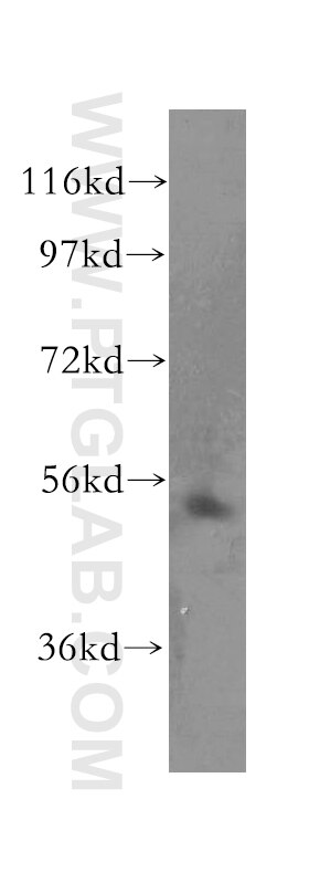 Western Blot (WB) analysis of human skeletal muscle tissue using TOM1 Polyclonal antibody (17506-1-AP)