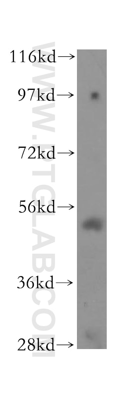 Western Blot (WB) analysis of K-562 cells using TOM1 Polyclonal antibody (17506-1-AP)