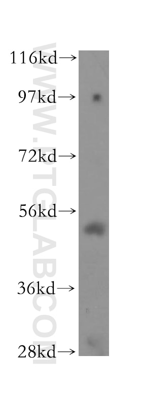 Western Blot (WB) analysis of K-562 cells using TOM1 Polyclonal antibody (17506-1-AP)