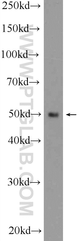 Western Blot (WB) analysis of mouse heart tissue using TOM1 Polyclonal antibody (25813-1-AP)