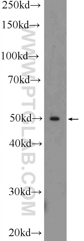 Western Blot (WB) analysis of mouse liver tissue using TOM1 Polyclonal antibody (25813-1-AP)