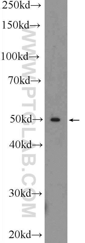 WB analysis of mouse liver using 25813-1-AP