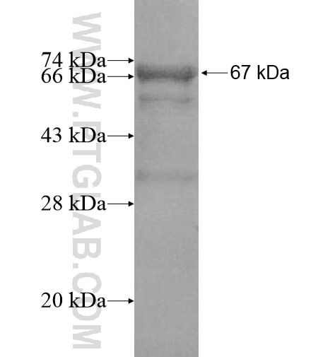 TOM1 fusion protein Ag11706 SDS-PAGE