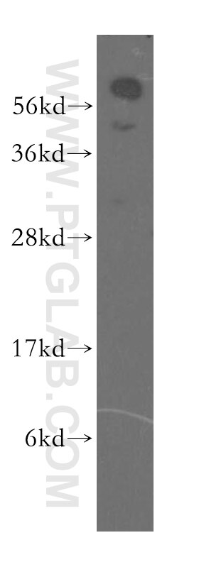 Western Blot (WB) analysis of HeLa cells using TOM1L1 Polyclonal antibody (51017-1-AP)