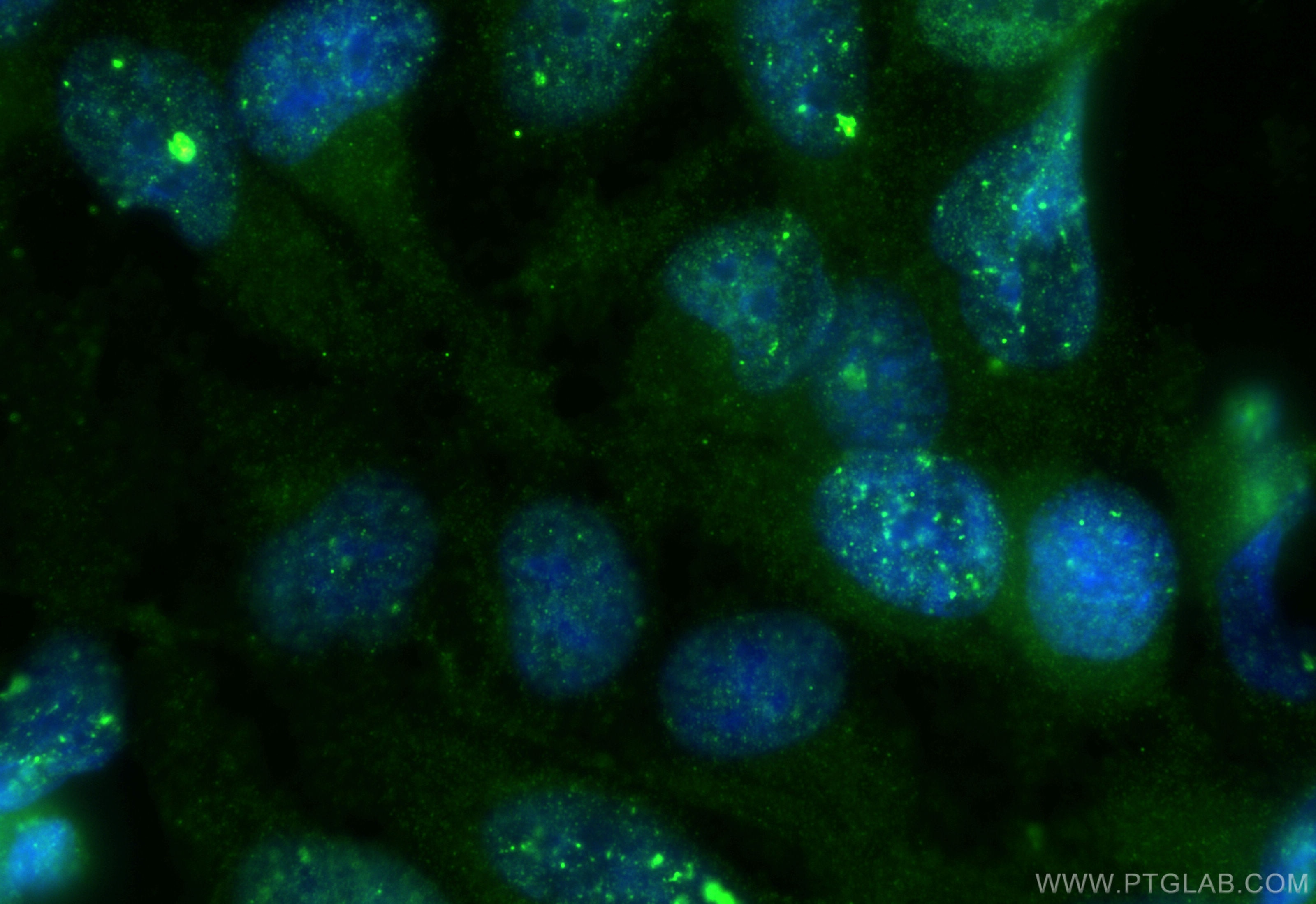 Immunofluorescence (IF) / fluorescent staining of HeLa cells using TOM1L2 Polyclonal antibody (32179-1-AP)