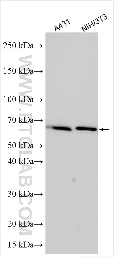 Western Blot (WB) analysis of various lysates using TOM1L2 Polyclonal antibody (32179-1-AP)